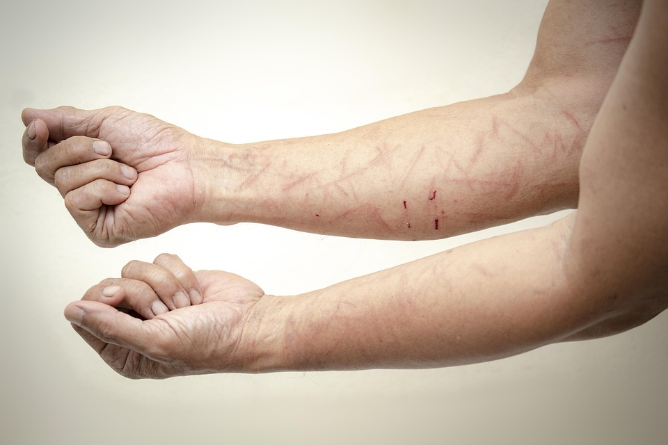 Rising from the Ashes: How Trauma Can Be a Catalyst for Growth